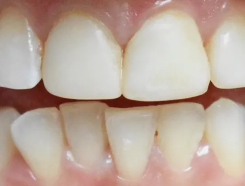 Before dental treatment